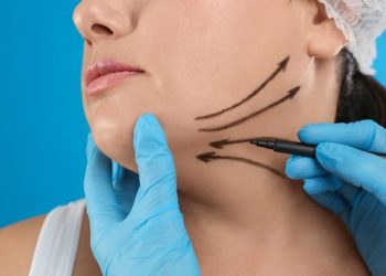 Double Chin Removal Singapore: What to Know before Considering Double Chin Removal