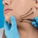 Double Chin Removal Singapore: What to Know before Considering Double Chin Removal