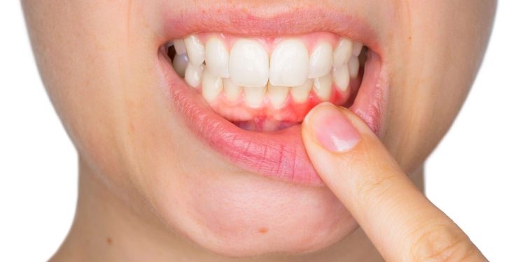 Can a dentist cure gum problems?