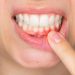 Can a dentist cure gum problems?