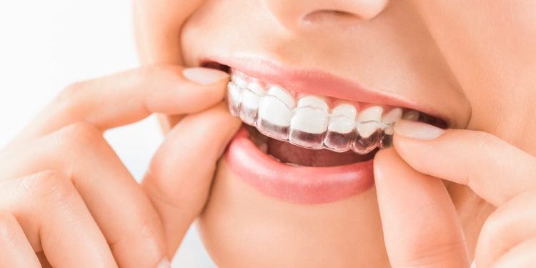 How Do Orthodontists Help You Restore Your Smile?