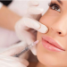Are You Considering Almost Getting A Radiesse Treatment?