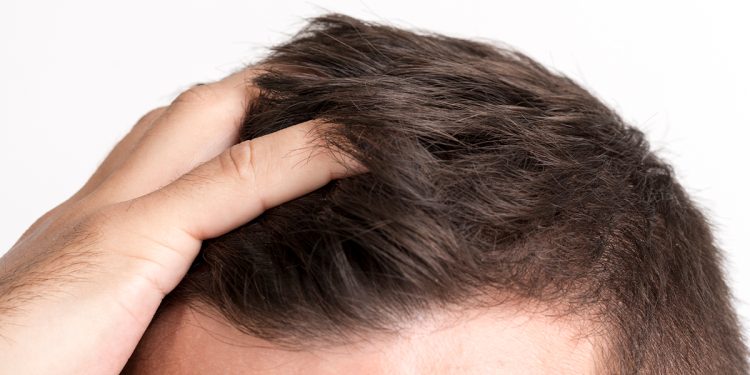 Hair Restoration Medical Center in Bangkok