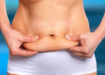 Is a Tummy Tuck Right for You? Unveiling the Ideal Candidates