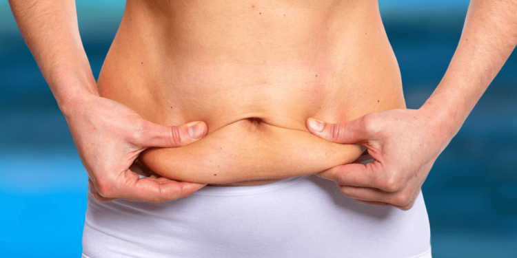 Is a Tummy Tuck Right for You? Unveiling the Ideal Candidates