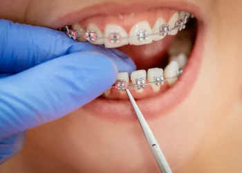 The importance of Orthodontics Weybridge