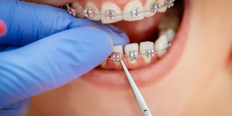 The importance of Orthodontics Weybridge