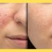 What To Expect During A Diamond Glow Facial