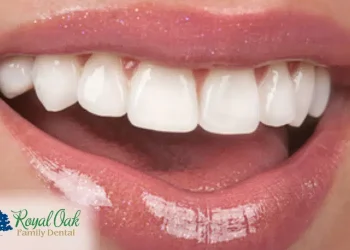 The Health Benefits Of Teeth Whitening In Adelaide: Beyond Aesthetics