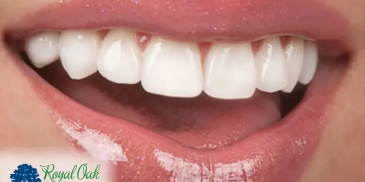 The Health Benefits Of Teeth Whitening In Adelaide: Beyond Aesthetics