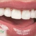 The Health Benefits Of Teeth Whitening In Adelaide: Beyond Aesthetics