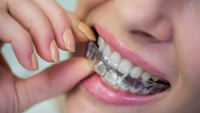 Discreet teeth straightening with Invisalign London