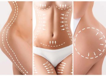Considering a Mommy Makeover? Here Are the Procedures You May Undergo