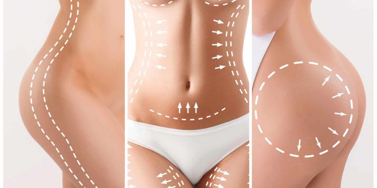 Considering a Mommy Makeover? Here Are the Procedures You May Undergo