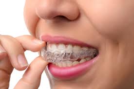 Which cases need Invisalign attachments and rubber bands?