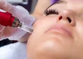 The Path to Results: What to Expect with Microneedling and Longevity Care