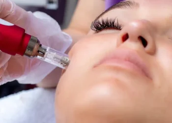 The Path to Results: What to Expect with Microneedling and Longevity Care