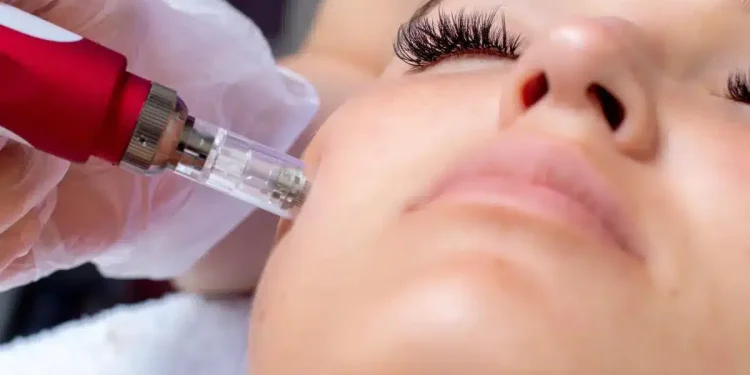 The Path to Results: What to Expect with Microneedling and Longevity Care