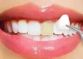 Cosmetic Dentistry in San Francisco: Refreshing Your Smile with Precision and Care