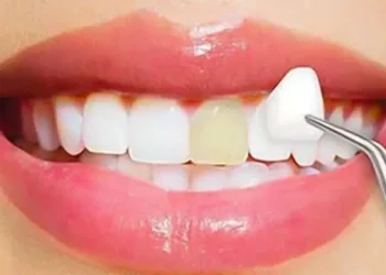 Cosmetic Dentistry in San Francisco: Refreshing Your Smile with Precision and Care