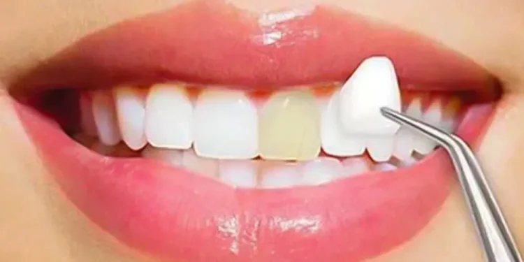 Cosmetic Dentistry in San Francisco: Refreshing Your Smile with Precision and Care
