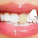 Cosmetic Dentistry in San Francisco: Refreshing Your Smile with Precision and Care